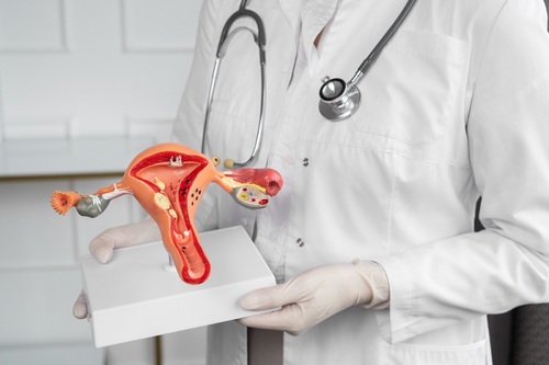 Diagnoses of Endometriosis